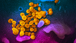 This scanning electron microscope image shows SARS-CoV-2 (yellow)—also known as 2019-nCoV, the virus that causes COVID-19—isolated from a patient in the U.S., emerging from the surface of cells (blue/pink) cultured in the lab. Credit: NIAID-RML